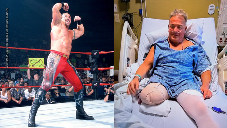 2025-850-buff-bagwell-amputation